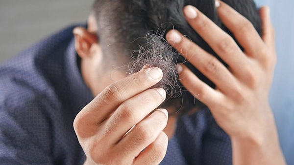 Estos son los peligros que te exponés por no lavarte el pelo en varios días, según una dermatóloga